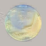 Chronic Respiratory Diseases: Think Non-Tuberculous Mycobacteria!