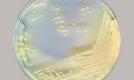 Enfermedades respiratorias crónicas: Piense en las micobacterias no tuberculosas