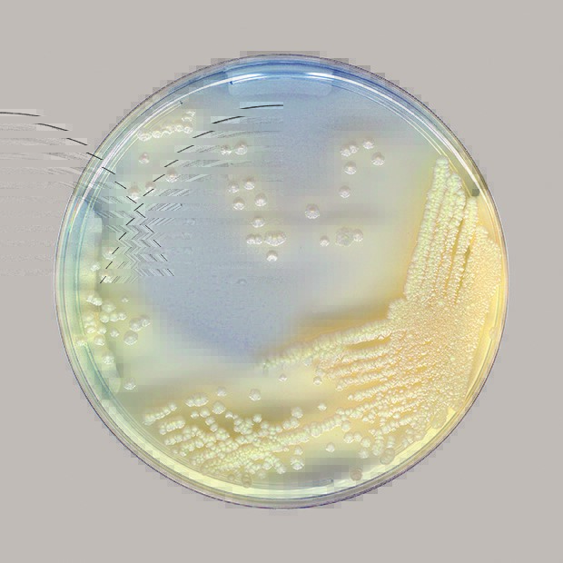 CHROMID NTM elite agar